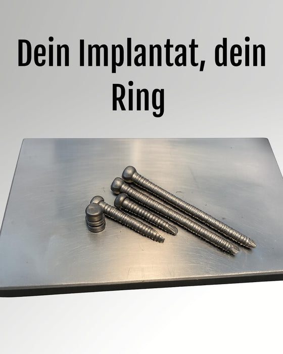Aus Implantat wird Schmuck – Maßgefertigte Ringe aus Titan und Silber