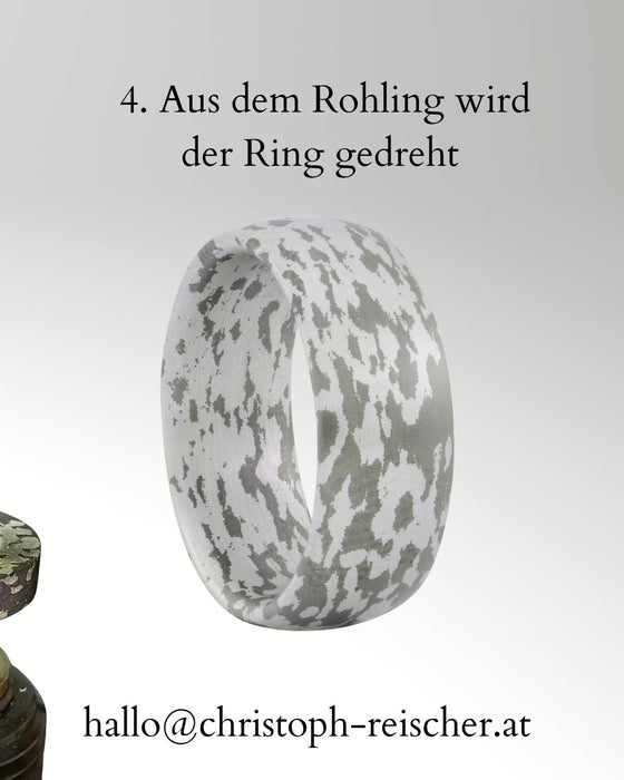 Aus Implantat wird Schmuck – Maßgefertigte Ringe aus Titan und Silber